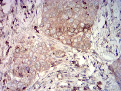 Валидация AntibodySystem RHD00202 (1266)