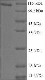 SDS-PAGE