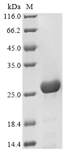 SDS-PAGE