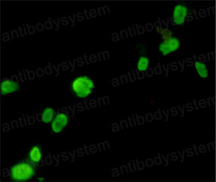 Валидация IF - AntibodySystem RHJ52504