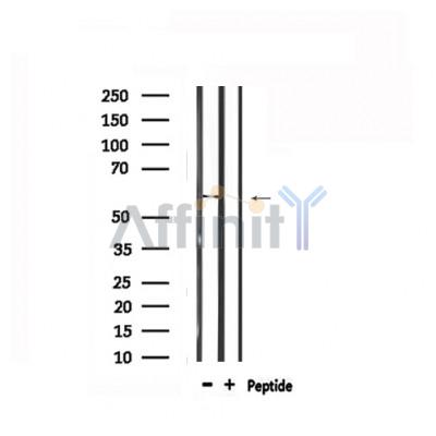 Валидация Affinity DF6465 - 17853