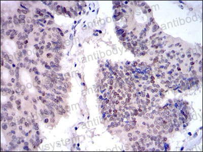 Валидация AntibodySystem RHG90702