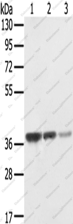 Вестерн-блоттинг, STX16, клетки MCF7, A172 и HepG2