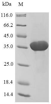 SDS-PAGE