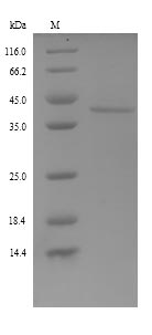 SDS-PAGE