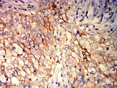 Валидация AntibodySystem RHM00303 (3758)