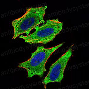 Валидация IF - AntibodySystem RHN93701 (1666)