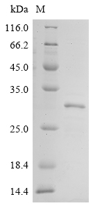 SDS-PAGE