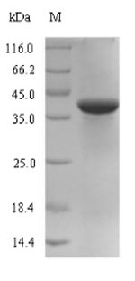 SDS-PAGE