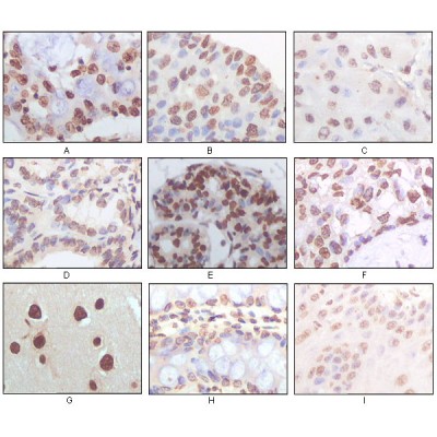 Валидация Affinity BF0580 - 5308