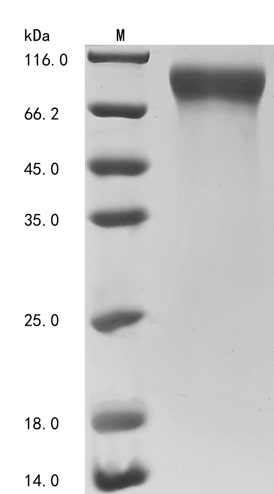 SDS-PAGE