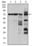 Валидация AssayVector ARM1716(2020)