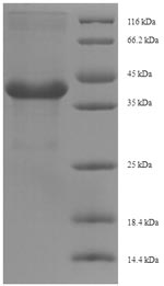 SDS-PAGE