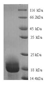 SDS-PAGE