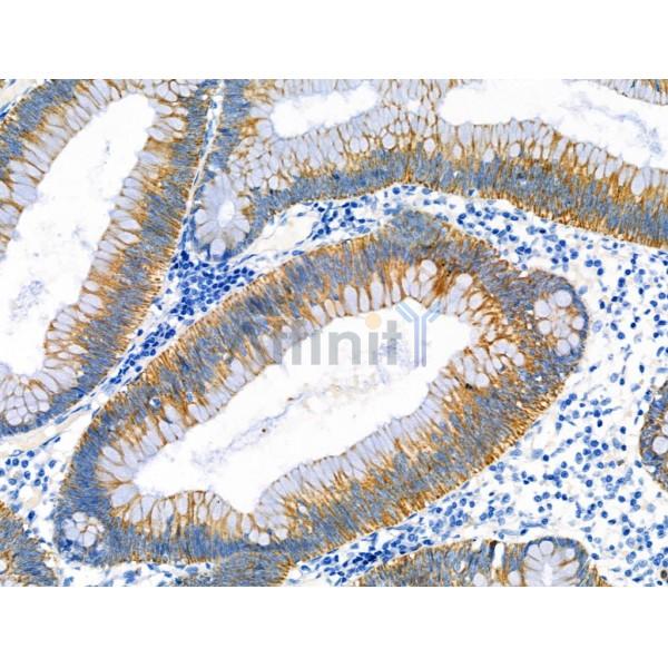 Валидация Affinity DF6481 - 17876