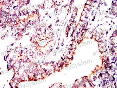 Валидация AntibodySystem RHC33504 (910)