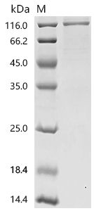 SDS-PAGE