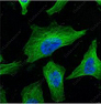 Иммунофлуоресценция, beta Tubulin, клетки HeLa