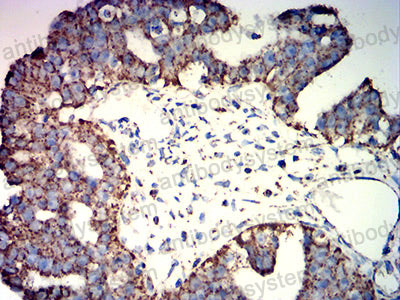 Валидация AntibodySystem RHD67603