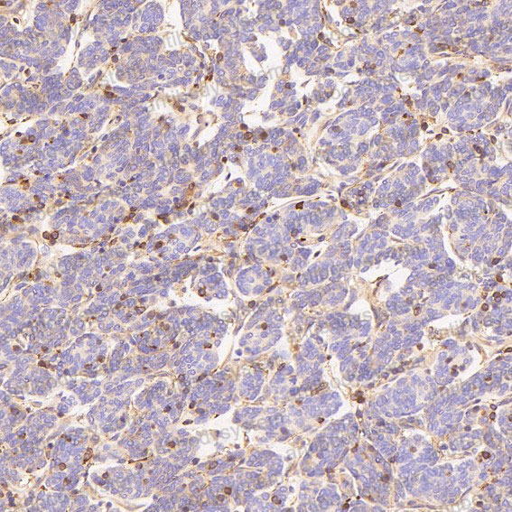 Валидация AntibodySystem RHD23201 (1413)