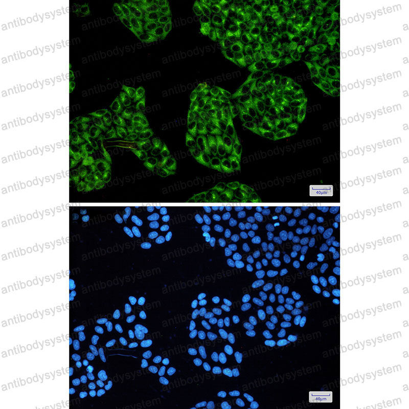 Валидация IF - AntibodySystem RHD25101