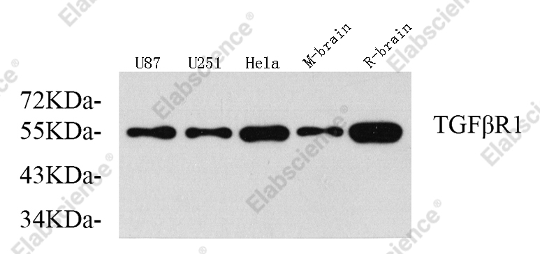 Вестерн-блоттинг, TGF β Receptor I, различные образцы