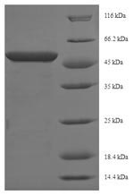 SDS-PAGE