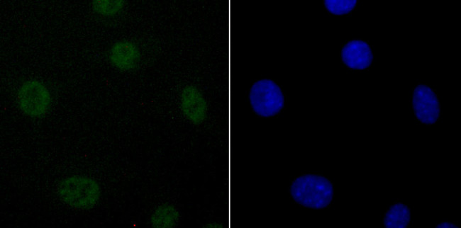 Валидация AssayVector ARM2662(4979)