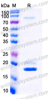 AHD28101, SDS-PAGE