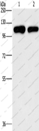 Вестерн-блоттинг, PIP5K1C, клетки A431 и HeLa