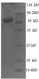 SDS-PAGE