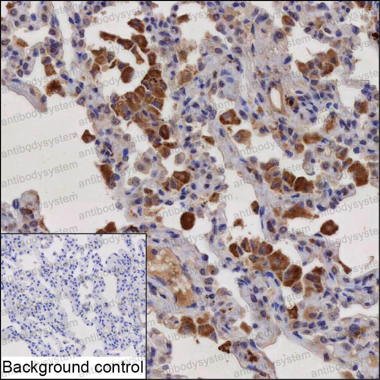 Валидация AntibodySystem RHA99801
