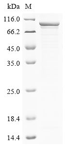 SDS-PAGE