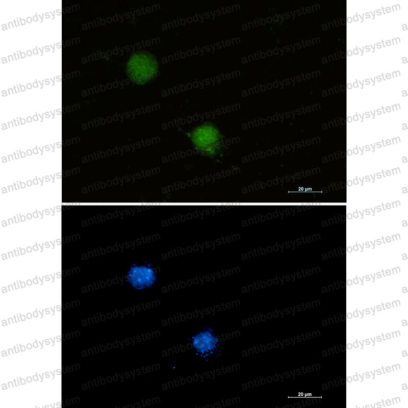 Валидация IF - AntibodySystem RHJ37102