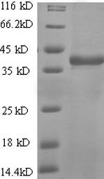 SDS-PAGE