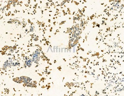 Валидация Affinity DF4140 - 15445