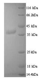 SDS-PAGE