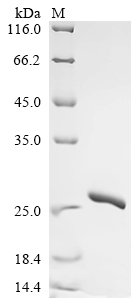 SDS-PAGE