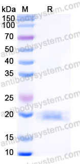 EHJ05901, SDS-PAGE