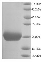 SDS-PAGE