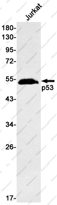 Вестерн-блоттинг, p53, клетки Jurkat