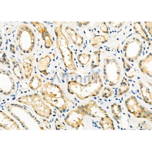 Валидация Affinity DF3608 - 14578