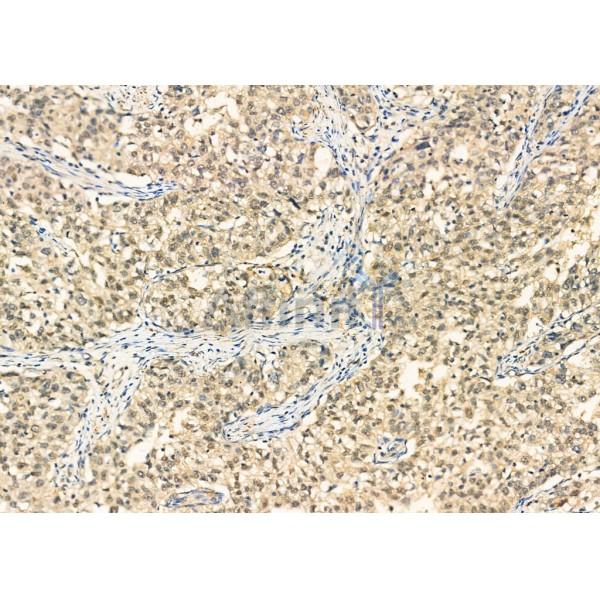 Валидация Affinity DF6521 - 17937