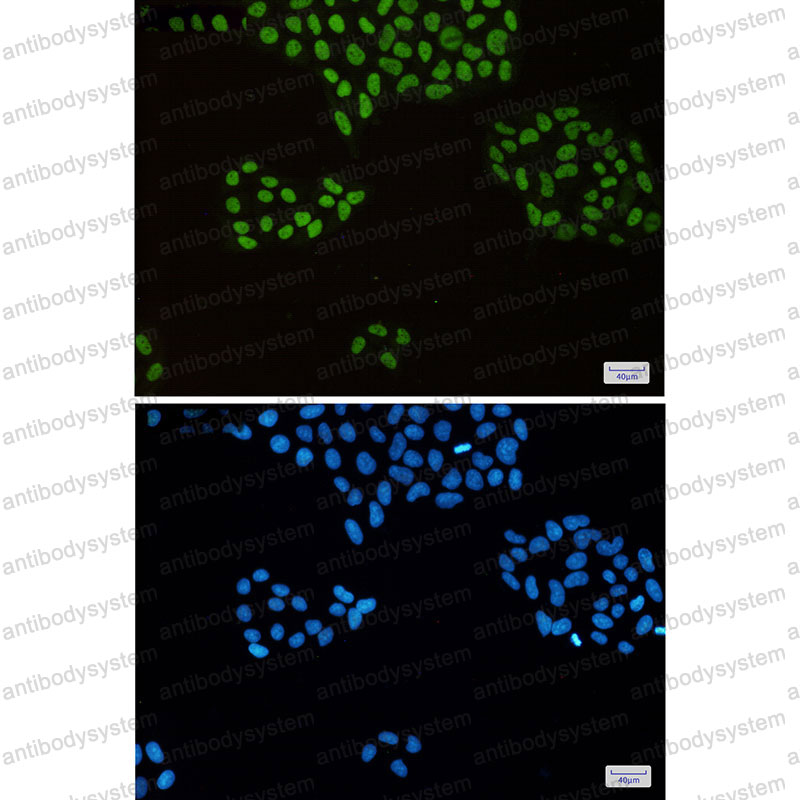 Валидация IF - AntibodySystem RHE68806