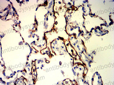 Валидация AntibodySystem RHJ10602 (3334)