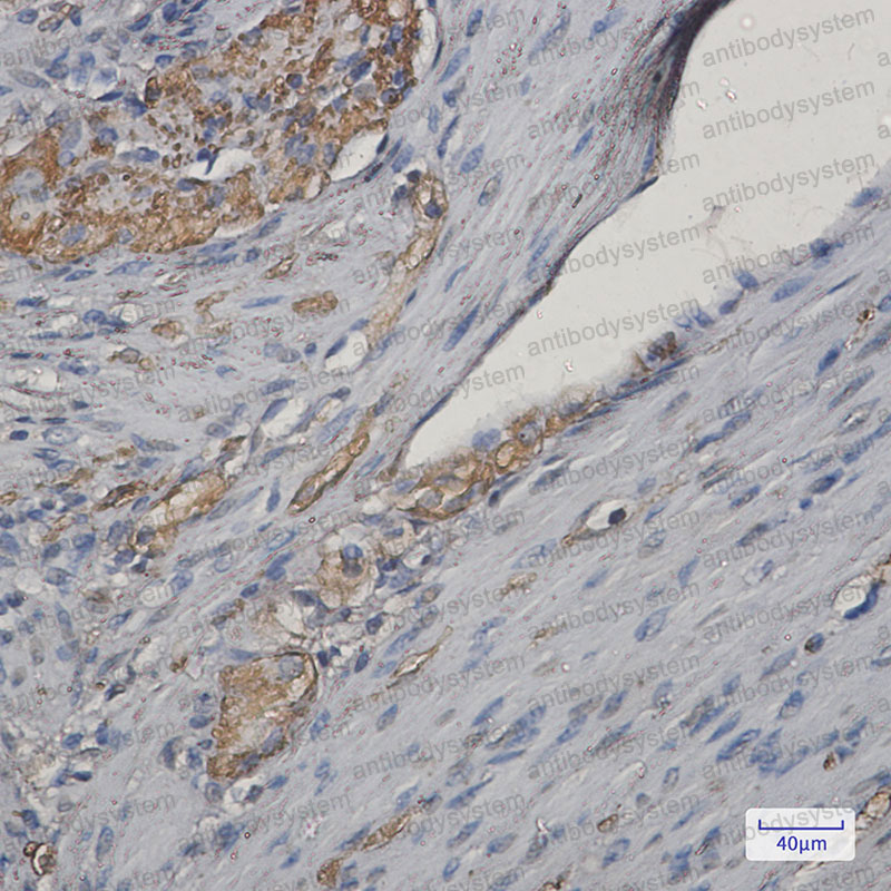 Валидация AntibodySystem RHN85601