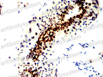 Валидация AntibodySystem RHN99301 (4045)