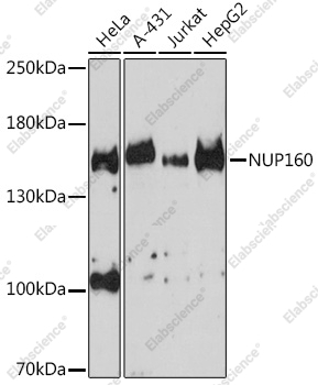 Вестерн-блоттинг, NUP160, различные клеточные линии