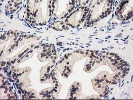 Валидация AssayVector ARM1715(2015)