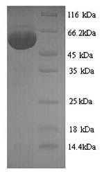 SDS-PAGE